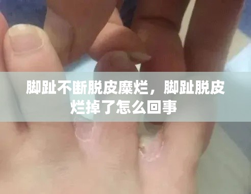 腳趾不斷脫皮糜爛，腳趾脫皮爛掉了怎么回事 