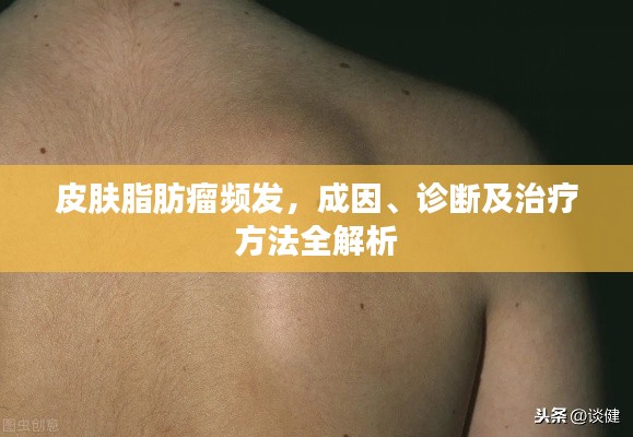 皮膚脂肪瘤頻發(fā)，成因、診斷及治療方法全解析