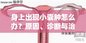 身上出現(xiàn)小囊腫怎么辦？原因、診斷與治療方法全解析