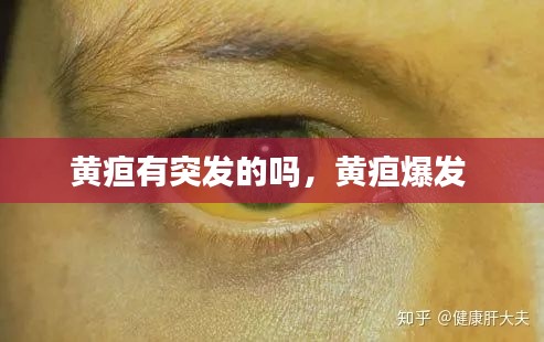 黃疸有突發(fā)的嗎，黃疸爆發(fā) 