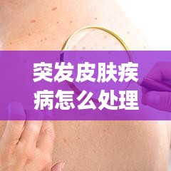 突發(fā)皮膚疾病怎么處理，突發(fā)皮膚瘙癢是什么原因 