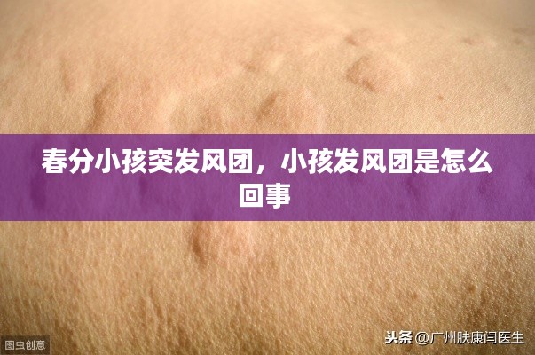 春分小孩突發(fā)風(fēng)團(tuán)，小孩發(fā)風(fēng)團(tuán)是怎么回事 