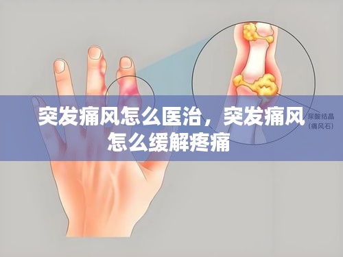 突發(fā)痛風怎么醫(yī)治，突發(fā)痛風怎么緩解疼痛 