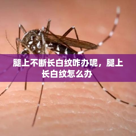 腿上不斷長白紋咋辦呢，腿上長白紋怎么辦 