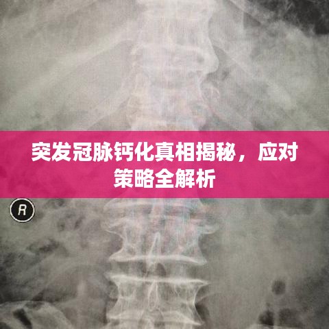 突發(fā)冠脈鈣化真相揭秘，應(yīng)對(duì)策略全解析