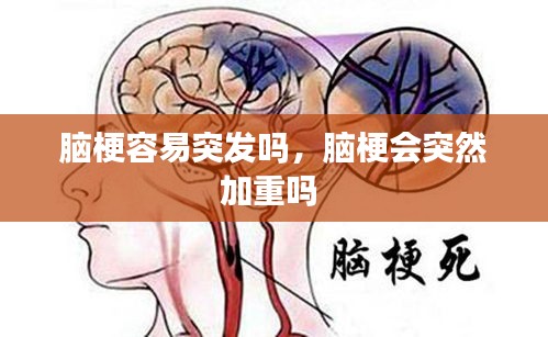 腦梗容易突發(fā)嗎，腦梗會(huì)突然加重嗎 