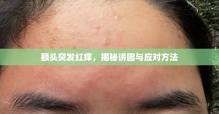 額頭突發(fā)紅癢，揭秘誘因與應(yīng)對方法