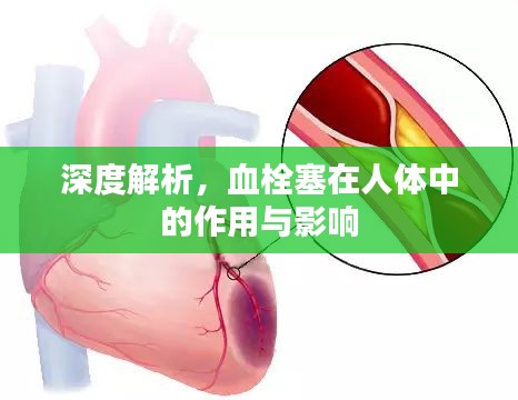 深度解析，血栓塞在人體中的作用與影響