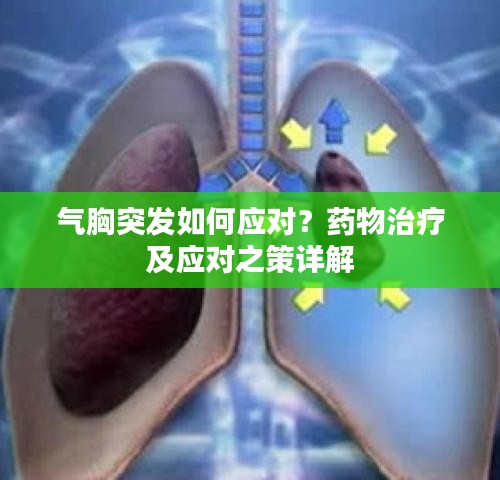 氣胸突發(fā)如何應(yīng)對？藥物治療及應(yīng)對之策詳解