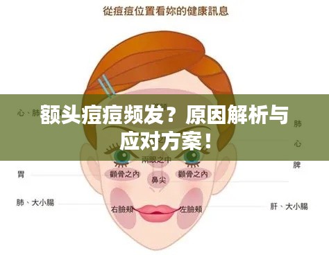 額頭痘痘頻發(fā)？原因解析與應(yīng)對(duì)方案！