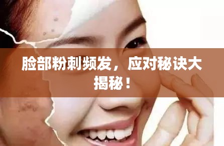 臉部粉刺頻發(fā)，應(yīng)對秘訣大揭秘！