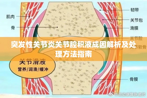 突發(fā)性關(guān)節(jié)炎關(guān)節(jié)腔積液成因解析及處理方法指南