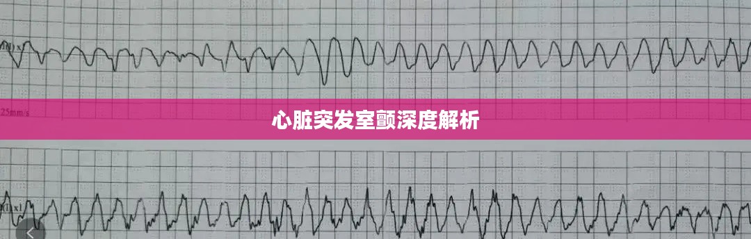 心臟突發(fā)室顫深度解析