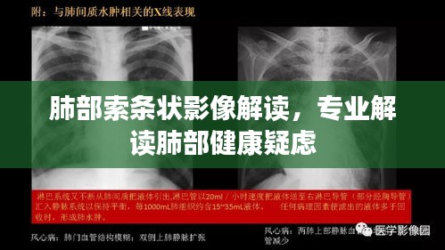 肺部索條狀影像解讀，專業(yè)解讀肺部健康疑慮