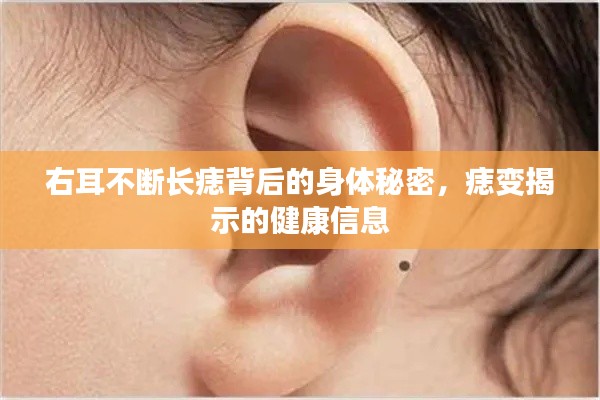 右耳不斷長痣背后的身體秘密，痣變揭示的健康信息